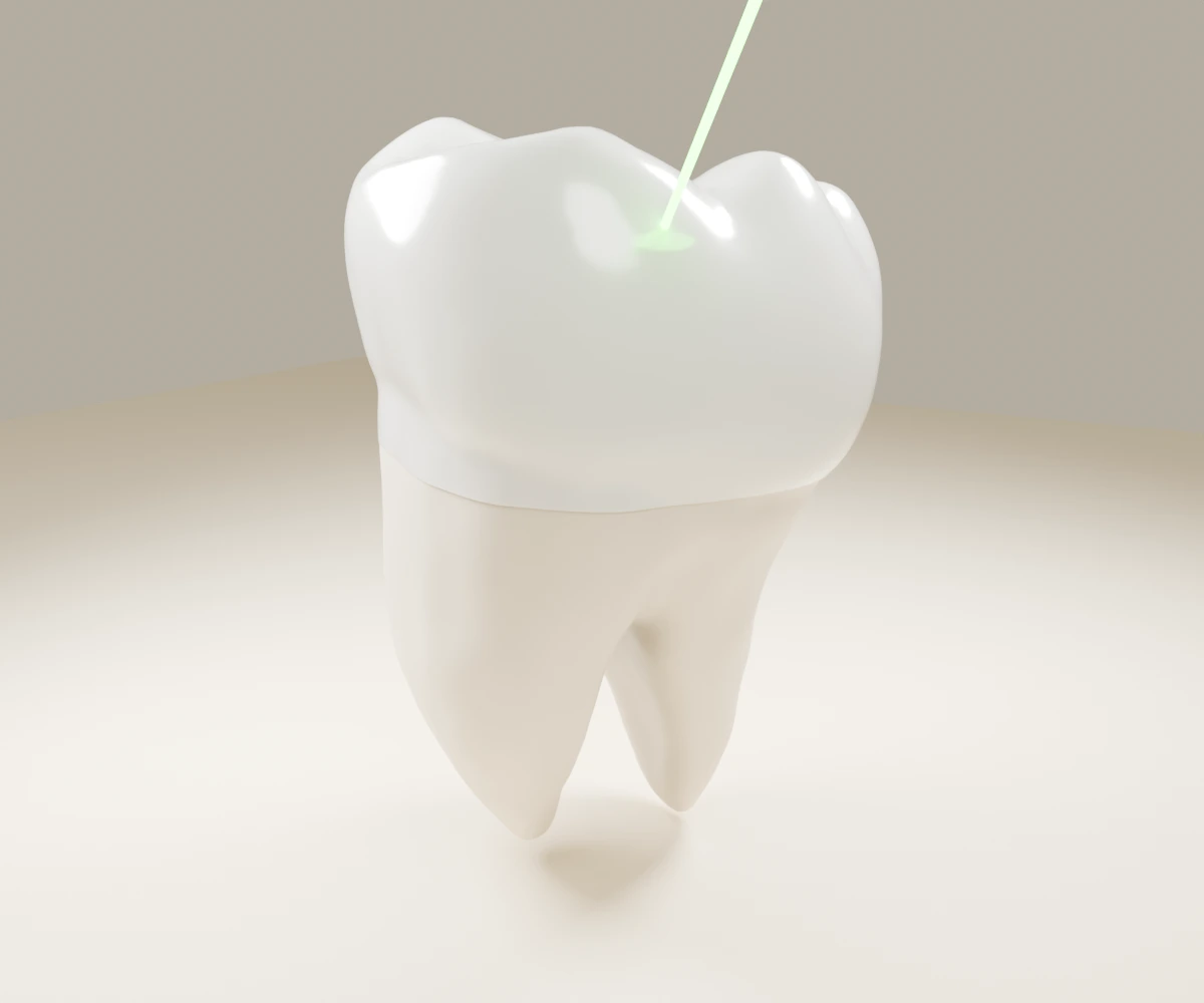 A realistic molar with its crown, roots, gum line and green laser point